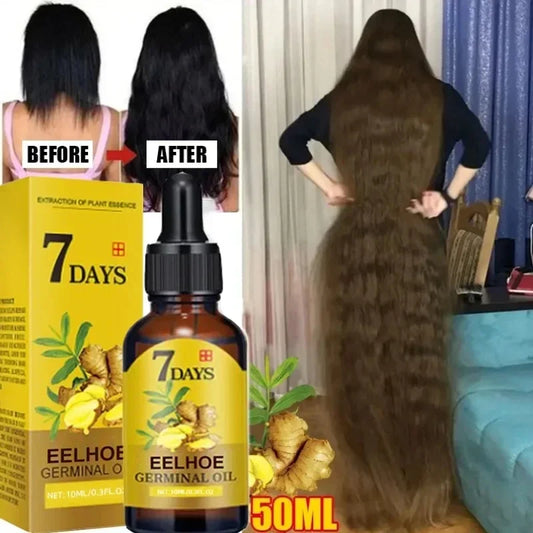 Anti Hair Loss, 7 Day Fast Hair Growth Ginger Oil for Men and Women