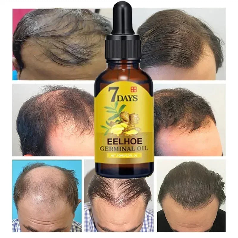 Anti Hair Loss, 7 Day Fast Hair Growth Ginger Oil for Men and Women